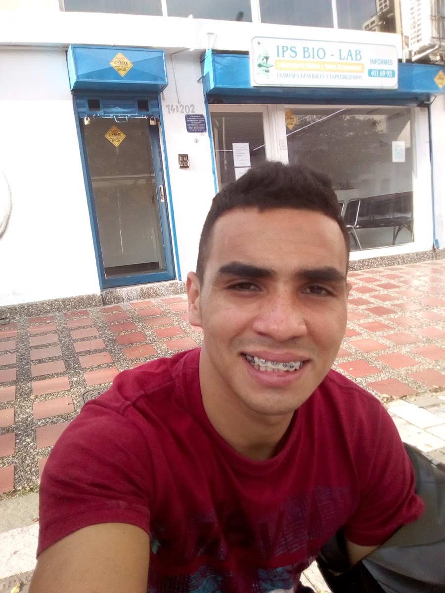 MANDINGA ZEA SALCHIPAPA